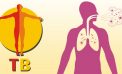As India sees rise in new TB cases, private sector notifications lag in Maha Ministry of health signs MoU with ministry of AYUSH over tuberculosis-free India initiative