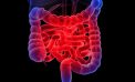 Here’s what you need to know about colorectal cancer