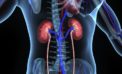 The ‘epidemic’ of kidney failure has reached gigantic proportions in India