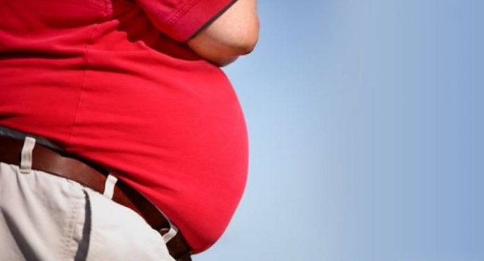 Know about the myths associated with obesity and bariatric surgery