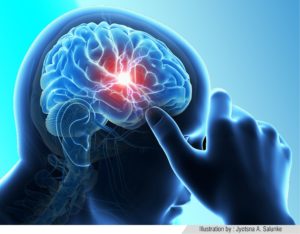 Brain stroke is fast growing threat to Indian youths