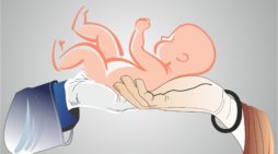 C-section controversy: Doctors term Maneka Gandhi’s demand to display caesarean rates ‘unfair’ C-section controversy: Doctors term Maneka Gandhi’s demand to display caesarean rates ‘unfair’