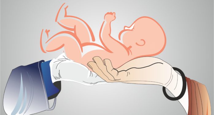 C-section controversy: Doctors term Maneka Gandhi’s demand to display caesarean rates ‘unfair’ C-section controversy: Doctors term Maneka Gandhi’s demand to display caesarean rates ‘unfair’