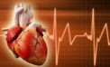 A wait at the OPD proves to be a boon Working for long hours can cause heart problems, reveals study